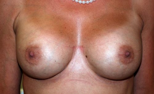 Dr Michel Heymans Chirurgie Plastique Reconstructrice Et Esth Tique